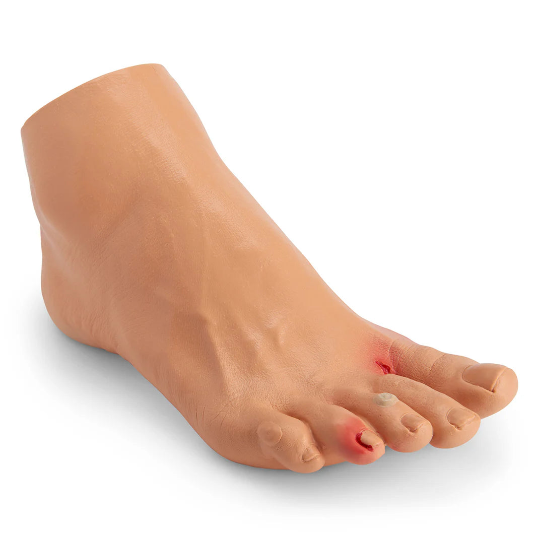 Common Foot Problems