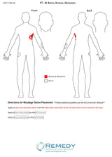 Moulage Tattoo Patient M Scenario