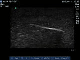 Ultrasound Phantom Foreign Body