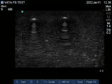 Ultrasound Phantom Foreign Body