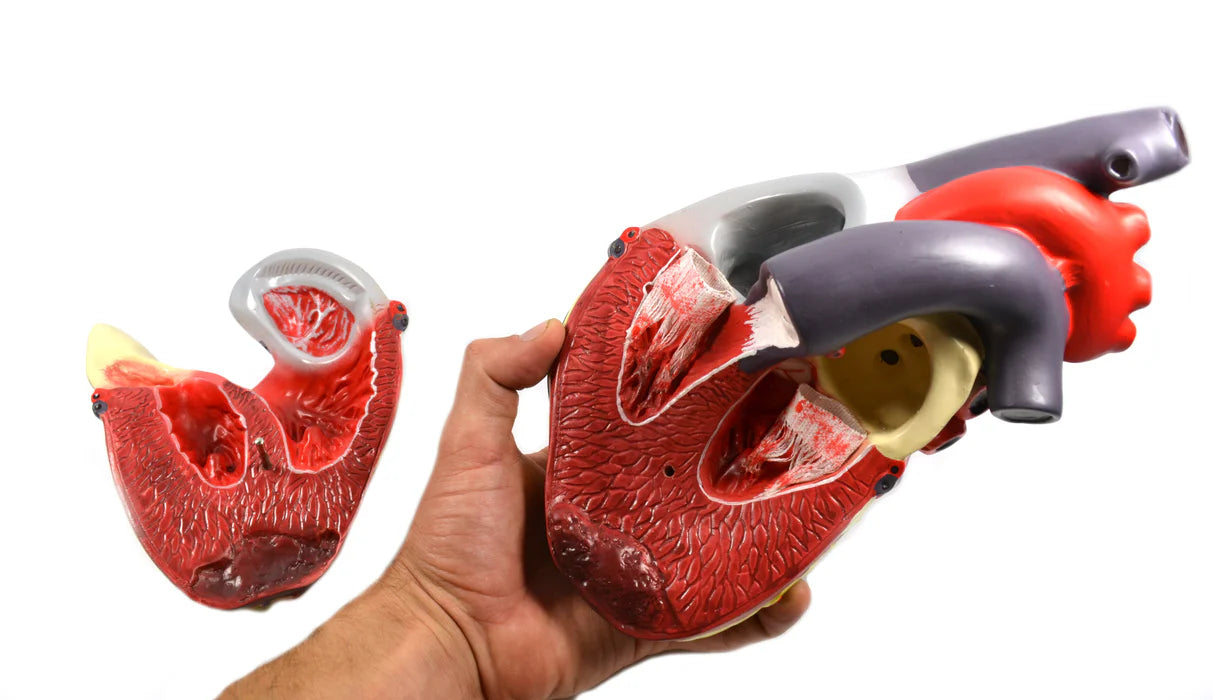 Human Heart Conditions Pathology