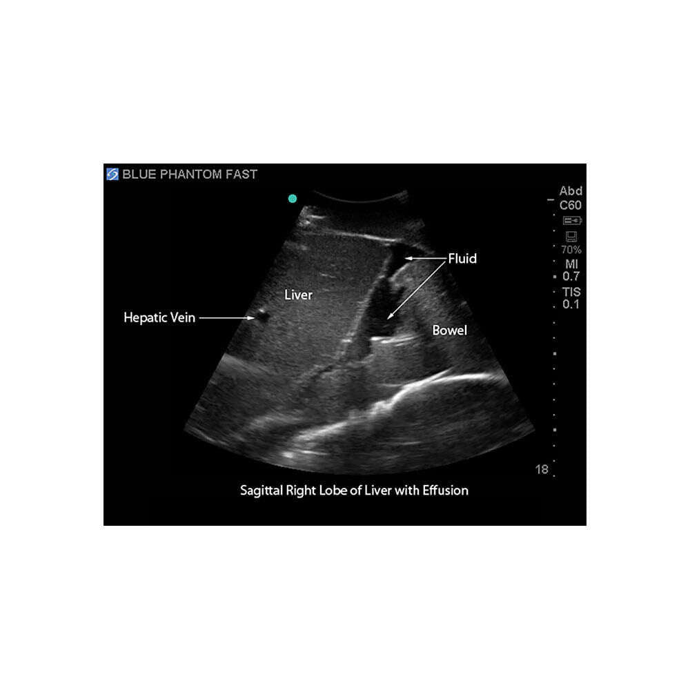 Blue Phantom FAST Exam Ultrasound Training Model