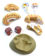 Human Brain with Arteries - 8 parts