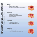 CuraFoam™ Foam Dressings