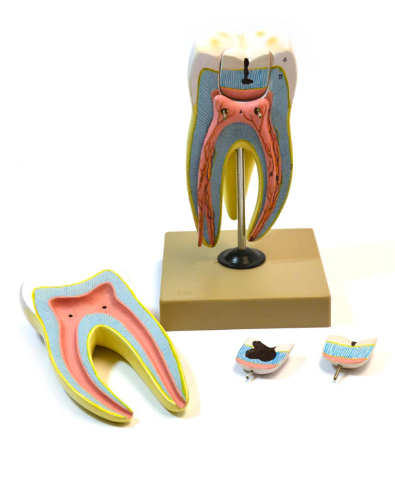 Upper Triple Root Molar with Interchangeable Cavities Model - 6 parts
