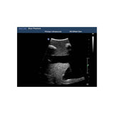 Blue Phantom Thoracentesis and Thoracostomy Ultrasound Training Model