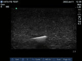 Ultrasound Phantom Foreign Body