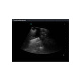 Blue Phantom Paracentesis Ultrasound Training Model