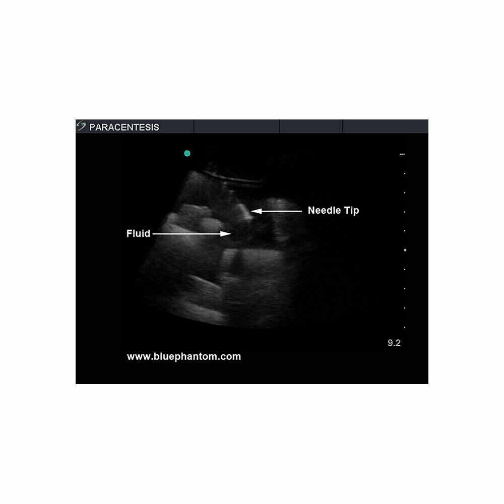 Blue Phantom Paracentesis Replacement Insert