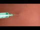 SONOtrain™ Gallbladder Model