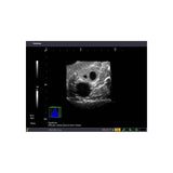 Blue Phantom Transvaginal Ultrasound Training Model