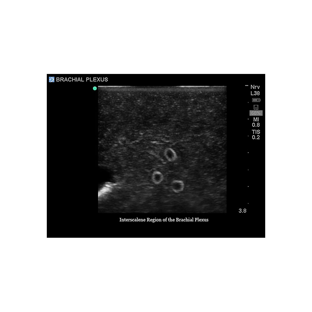 Blue Phantom Central Line and Regional Anesthesia Ultrasound Training Models