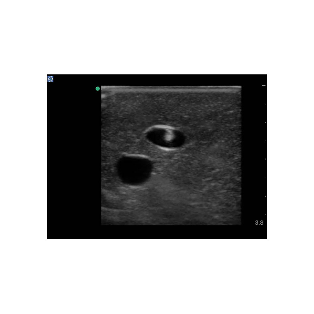 Blue Phantom Central Line and Regional Anesthesia Ultrasound Training Models