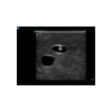 Blue Phantom Central Line and Regional Anesthesia Ultrasound Training Models