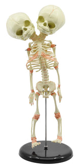 Mini Size Infant Fetus Skeleton Model, Twin, Conjoined Skull