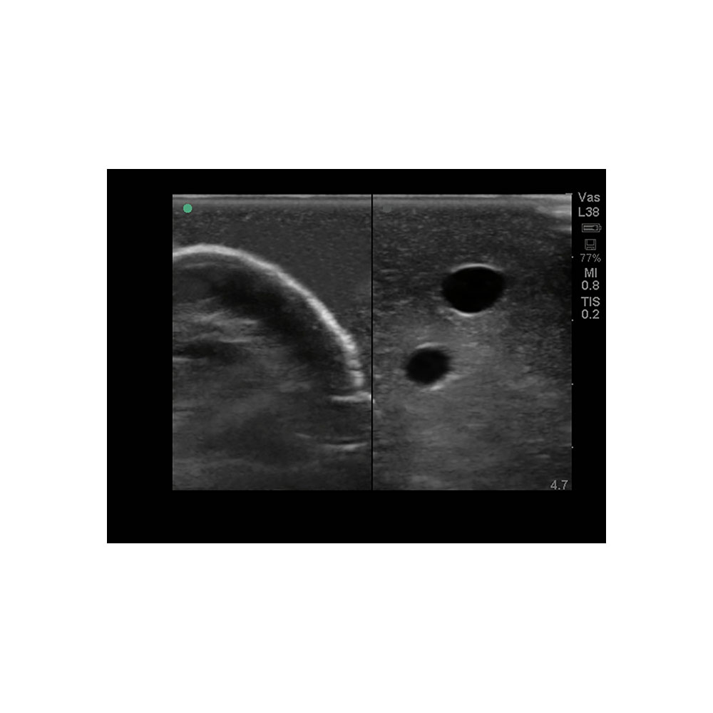 Blue Phantom Central Line and Regional Anesthesia Ultrasound Training Models